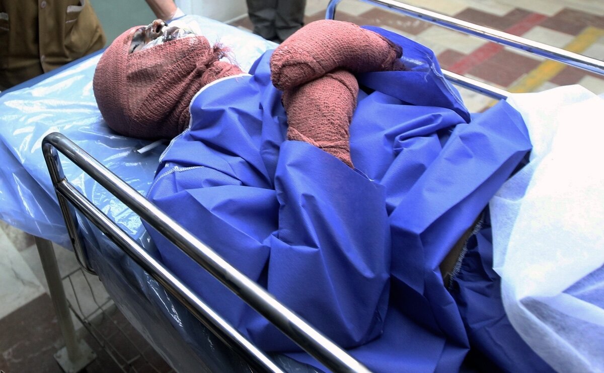 اسیدپاشی مرگبار برادر عصبانی